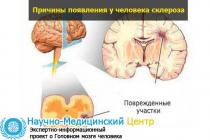 Различные виды склероза и их классификация Симптомы склероза